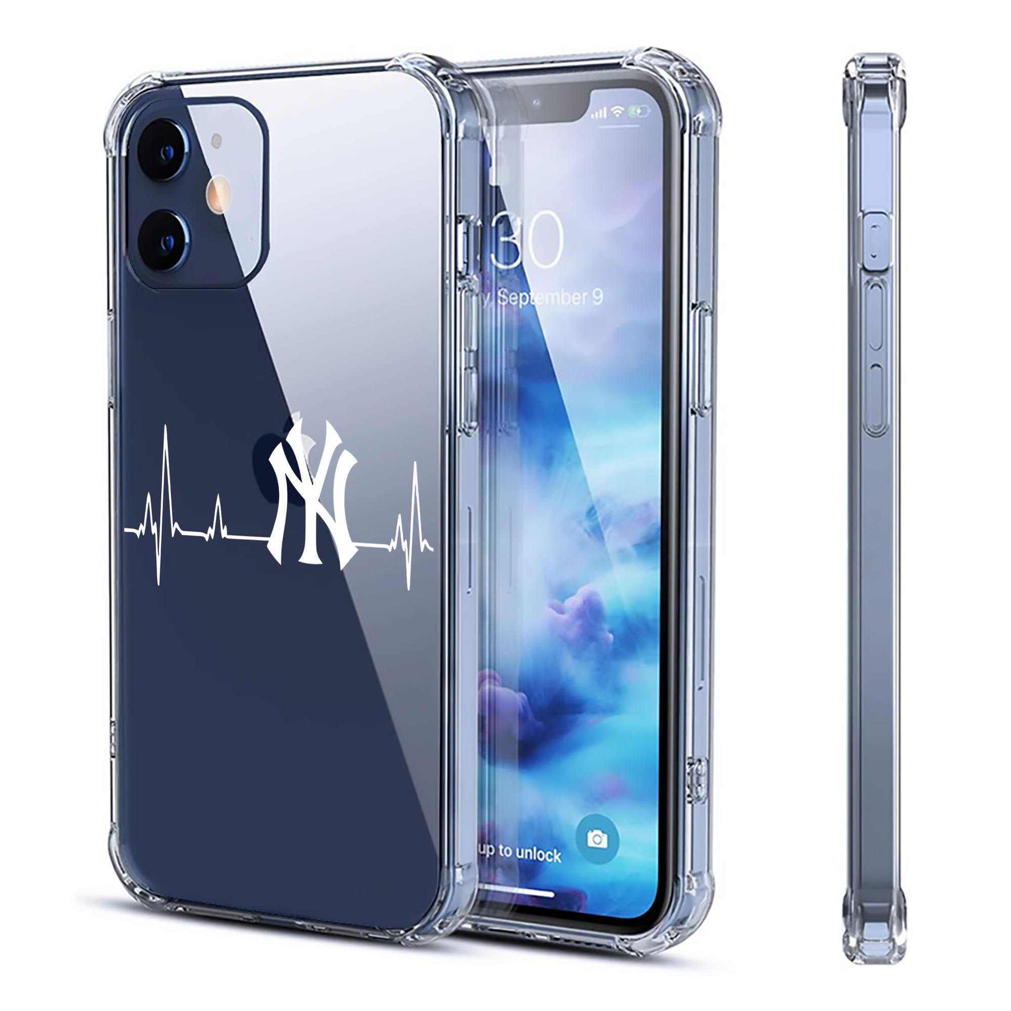 New York Yankees EKG Line Clear IPhone 12 Case – Soft TPU With UV Print – Enhanced Drop Protection, Precise Fit, Anti-Fingerprint, Customizable Design, Scratch-Resistant, Yellow-Resistant